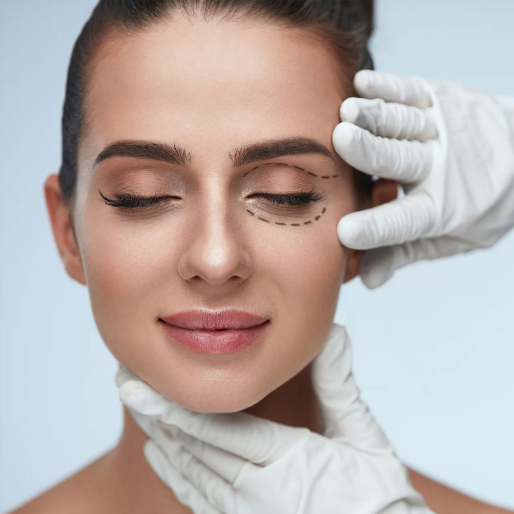 Blefaroplastia