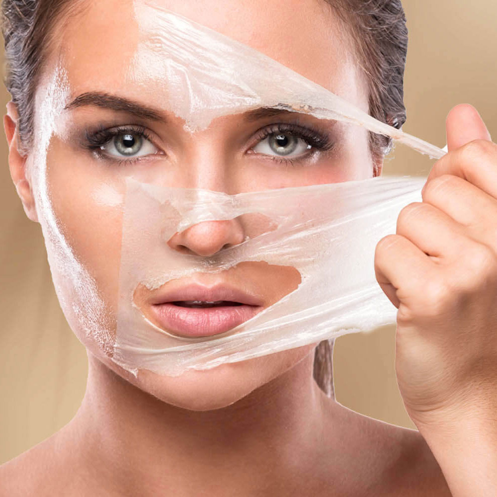 Peeling Químico